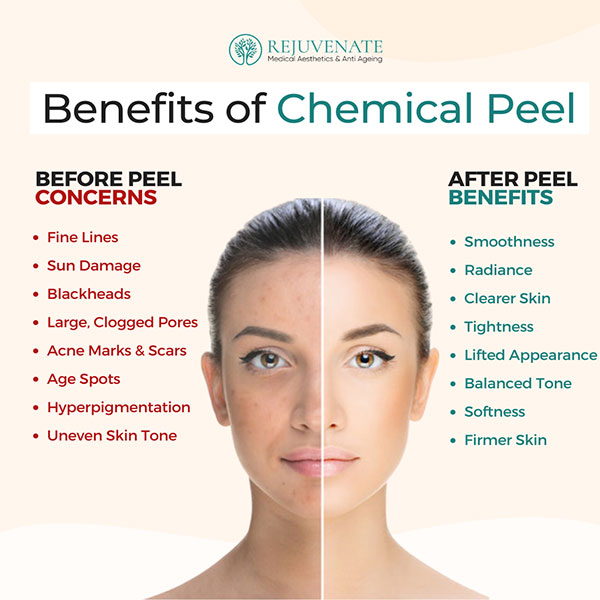 ChemicalPeel Benefits of Chemical Peel