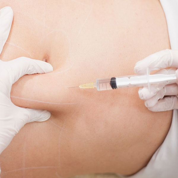 Lipo-Dissolve-Pro Lipo Dissolve Pro treatment