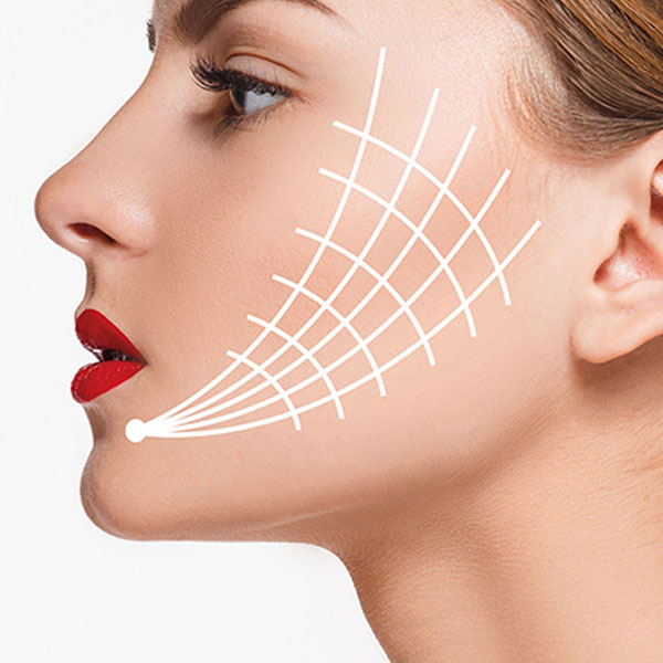 Thread-Lift Thread Lift Treatment in Delhi
