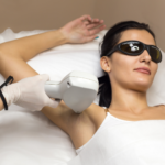 Laser Hair Reduction